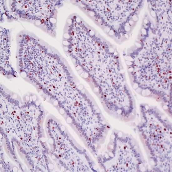 Vector Laboratories ImmPRESS VR Polymer HRP Anti-Rabbit IgG Reagent, 15 ml_1217137