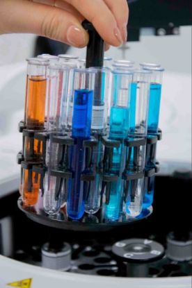 AMS Smartchem 450 Fully Automated Discrete Chemistry Analyzer with Reusable Optical Glass Cuvettes and 100 Sample Configuration, Up to 450 Tests per Hour, Includes Reagent Cooler and Touch Screen PC with Windows License and Smartchem Software_1926816