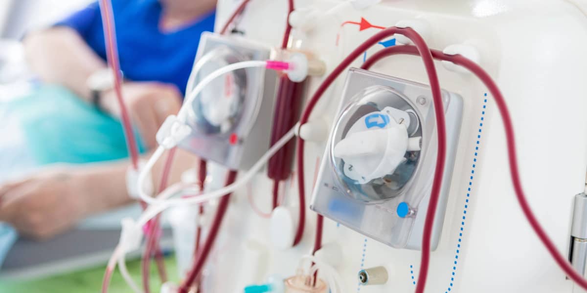 Dialysis machine with tubing and blood pump in clinical setting