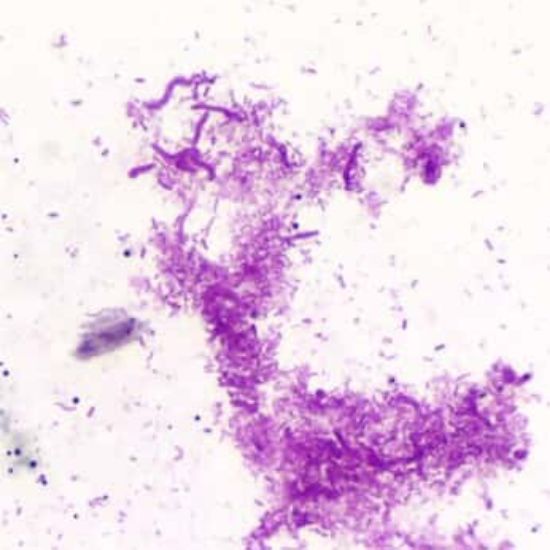 Cole-Parmer Essentials Prepared Slide, Bacteria, 3 Types_1925764